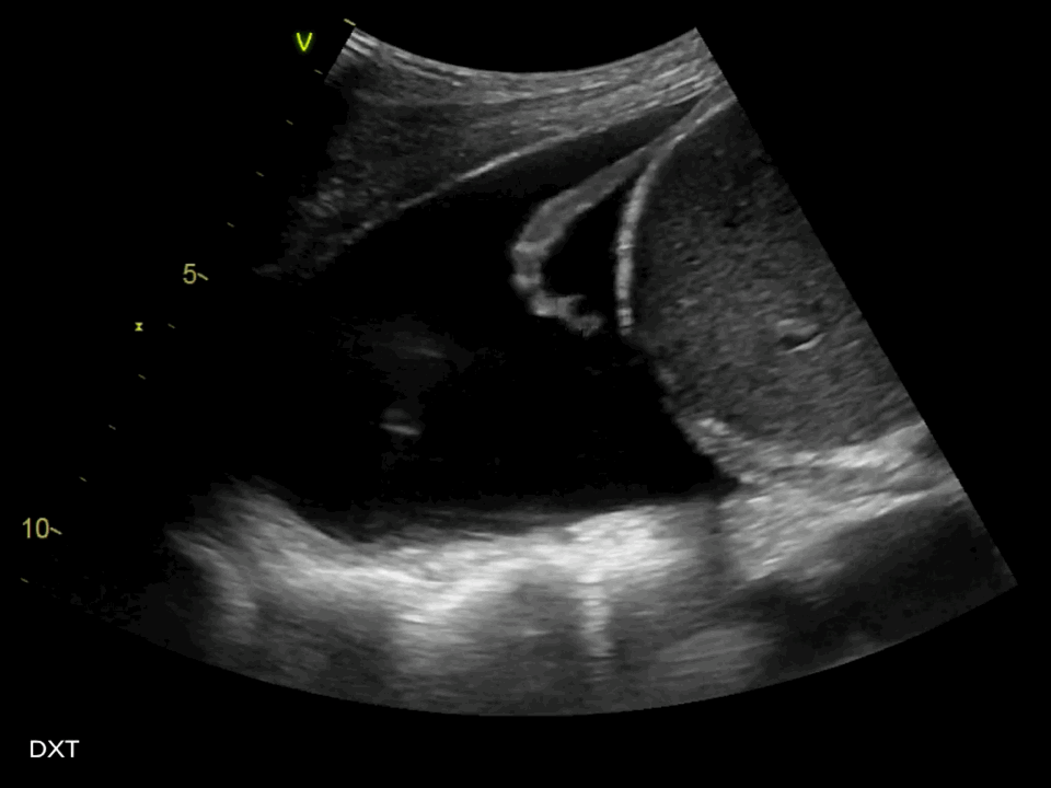 EEU case image missing